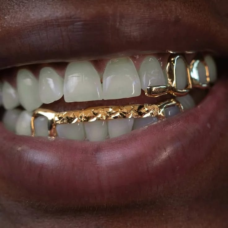 Grillz en France | Grillz sur mesure à distance – Grillz Worldwide