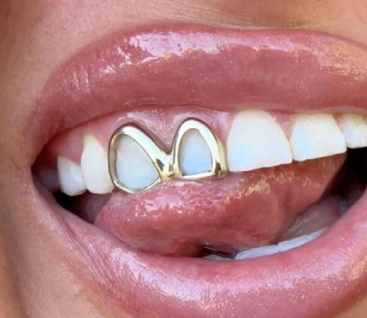 Grillz Guyane | Grillz Cayenne, Matoury & Saint-Laurent