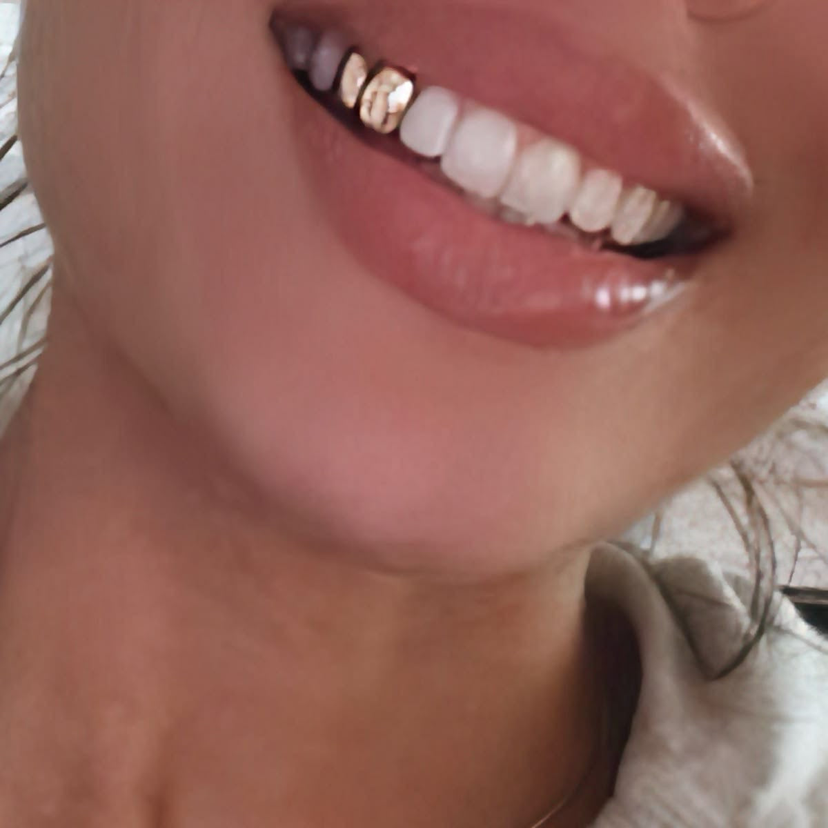 Grillz Rémire-Montjoly, Kourou &  Macouria | Grillz Worldwide