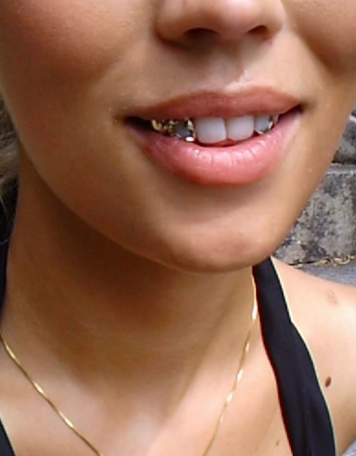 Grillz Argent & Or Guyane | Grillz Worldwide - Création sur mesure