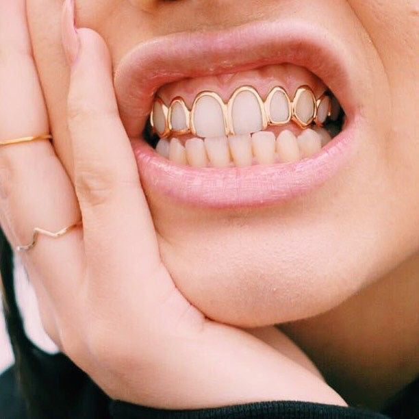 Grillz en Or Sur Mesure en France | Guide Complet 2026