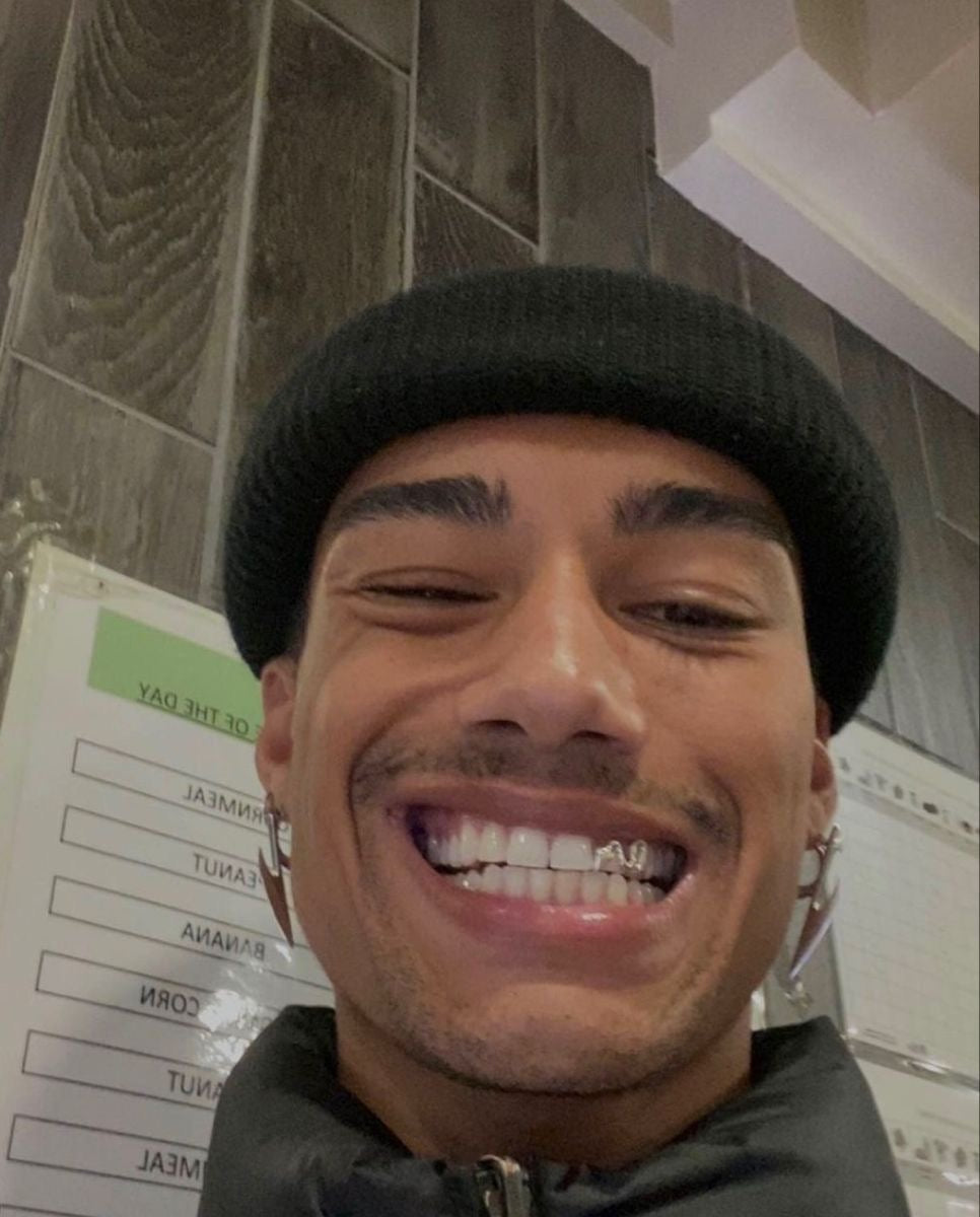 Grillz i København, Aarhus & Odense | Grillz Worldwide