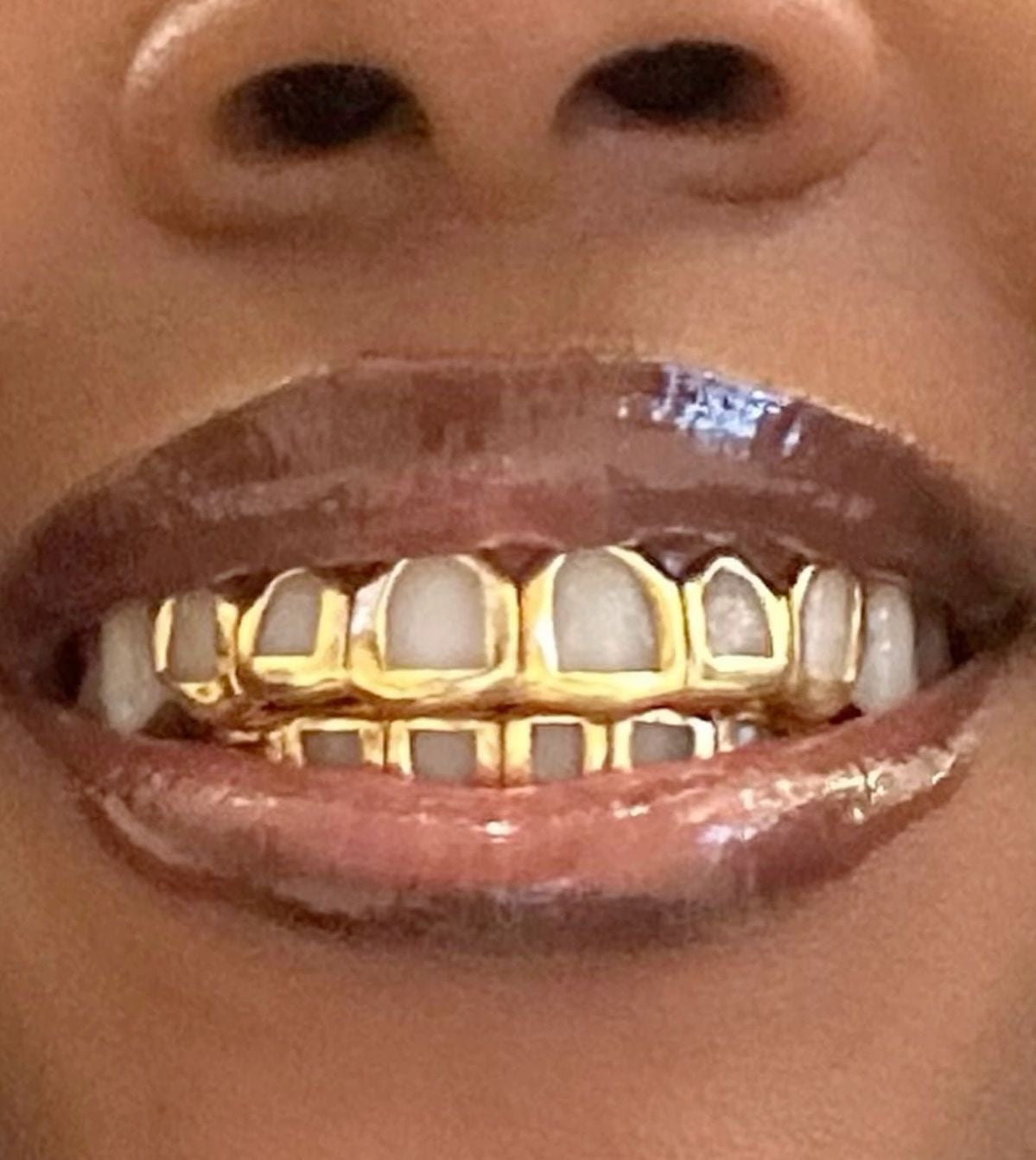 Grillz en Or Homme et Femme | Grillz Sur Mesure | Grillz Worldwide