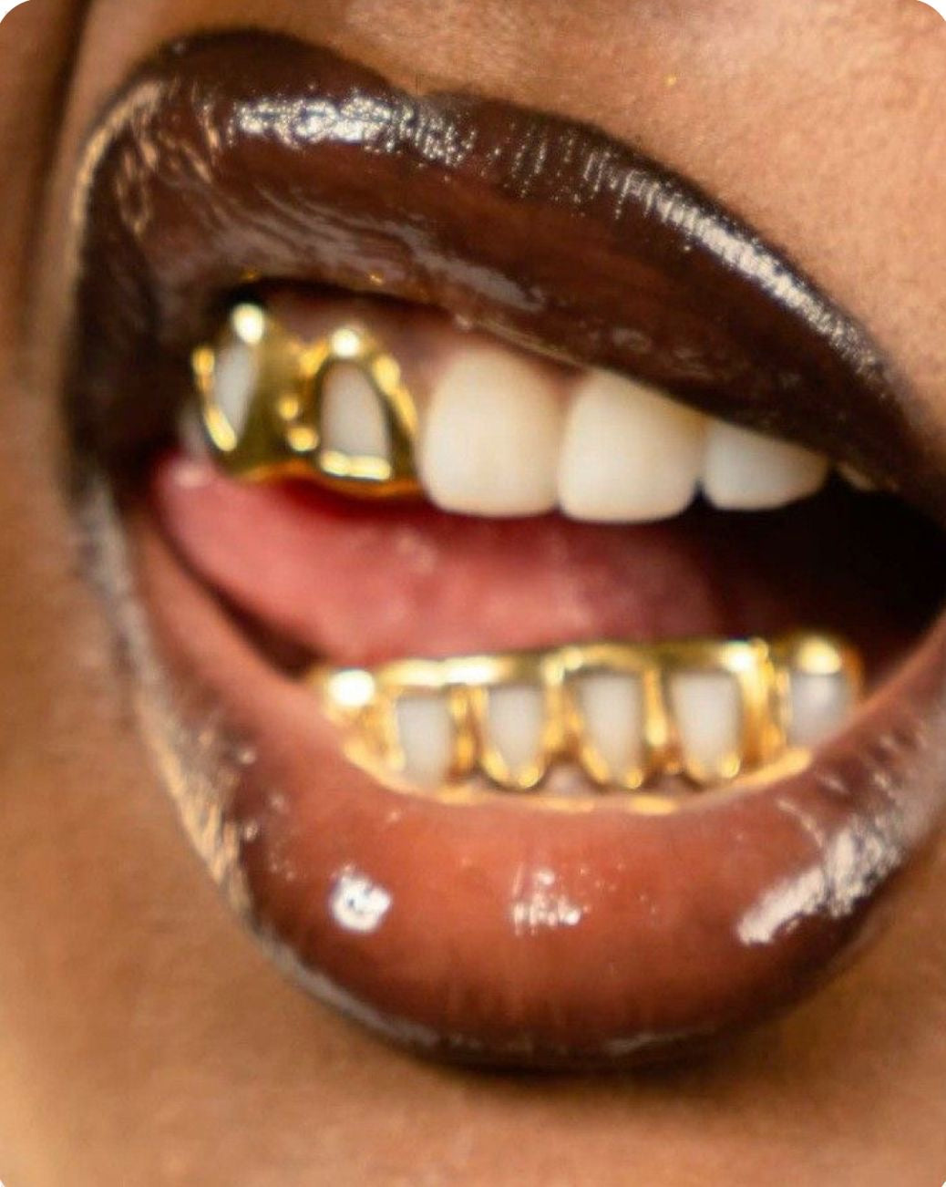 Grillz 14K vs 18K : Quelles Différences ? | Grillz Worldwide