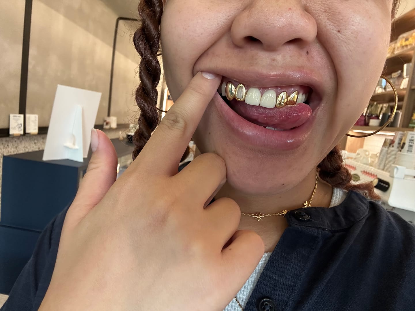 Gold Grillz in Switzerland: The Complete Guide to Custom Gold Grillz