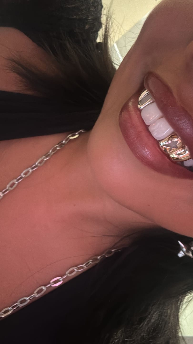 Grillz i Guld i Danmark – Skræddersyede Gold Grillz | Grillz Worldwide