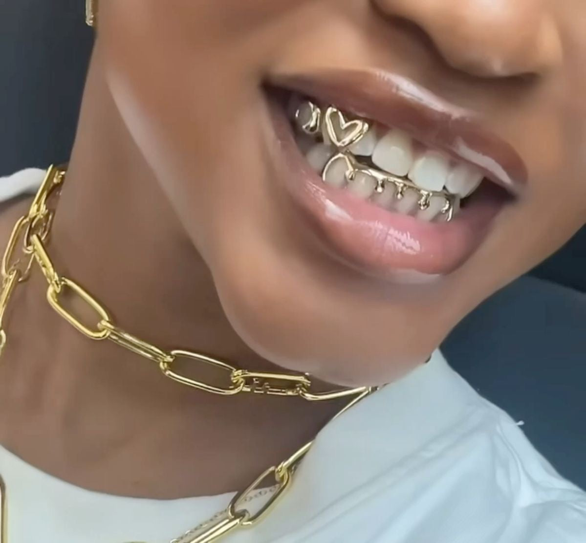 Grillz a Medida en España | Grillz Worldwide - Diseña tus Grillz Únicos