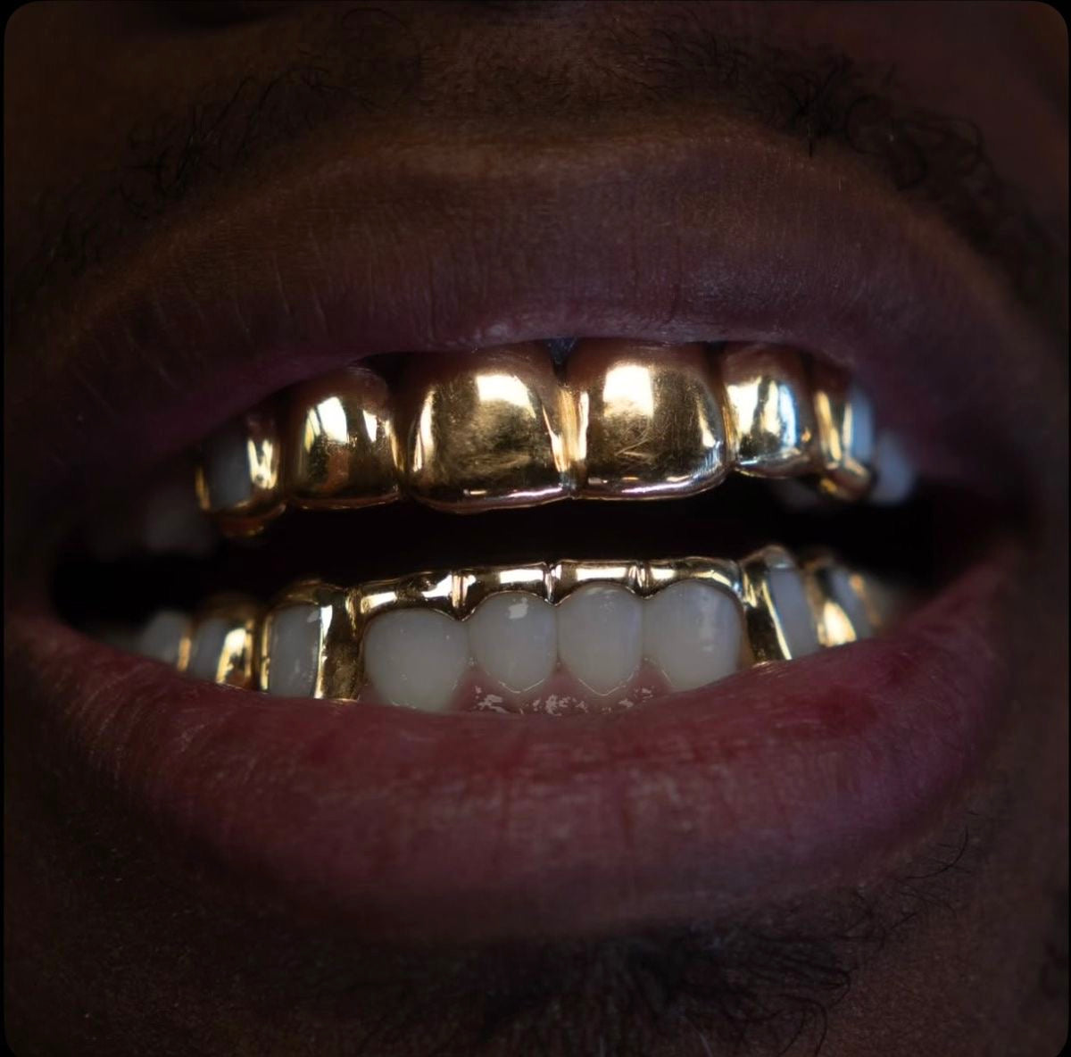 Grillz en Or en Belgique : Le Guide Complet des Grillz Sur Mesure