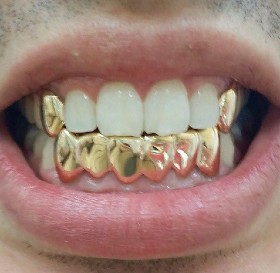 Grillz Norge | Gull Grillz & Sølvfargede Grillz på Mål – Grillz Worldwide