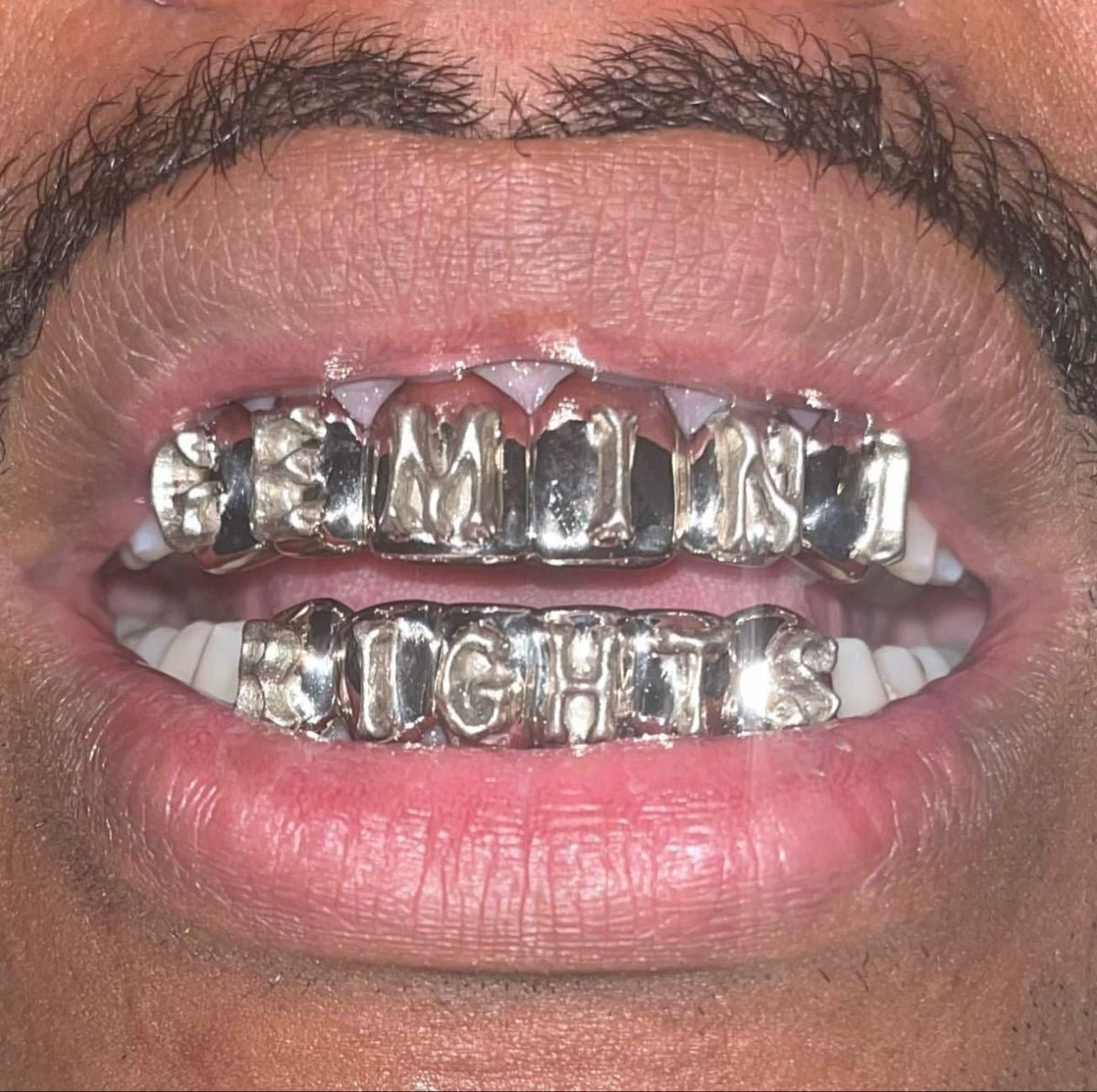 Grillz in Italia: Milano, Roma, Napoli e le Principali Città | Grillz Worldwide