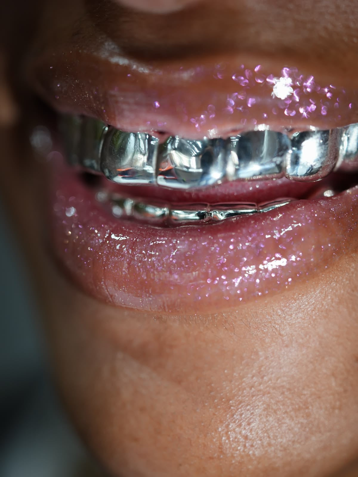 Grillz Italia | Grillz Oro e Argento Su Misura – Grillz Worldwide