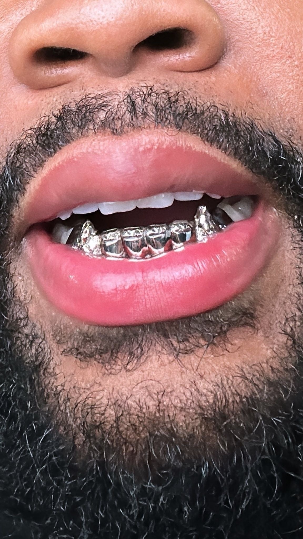 Grillz bijoux en France : où acheter un grillz sur mesure dans les régions et grandes villes clés ?