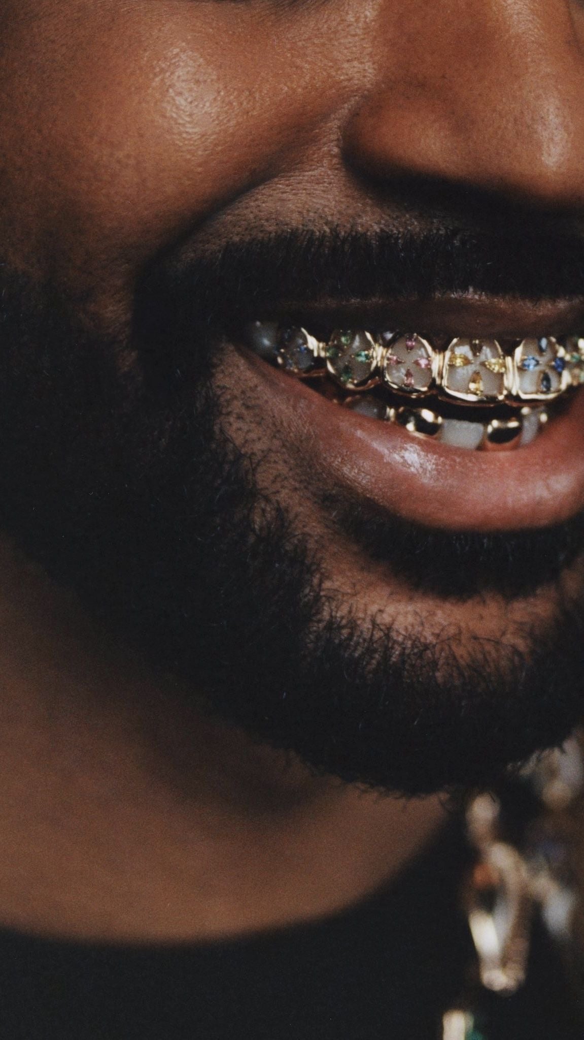 Grillz en France : Grillz sur mesure à Bayonne, Pau, Toulouse et Bordeaux – Grillz Worldwide