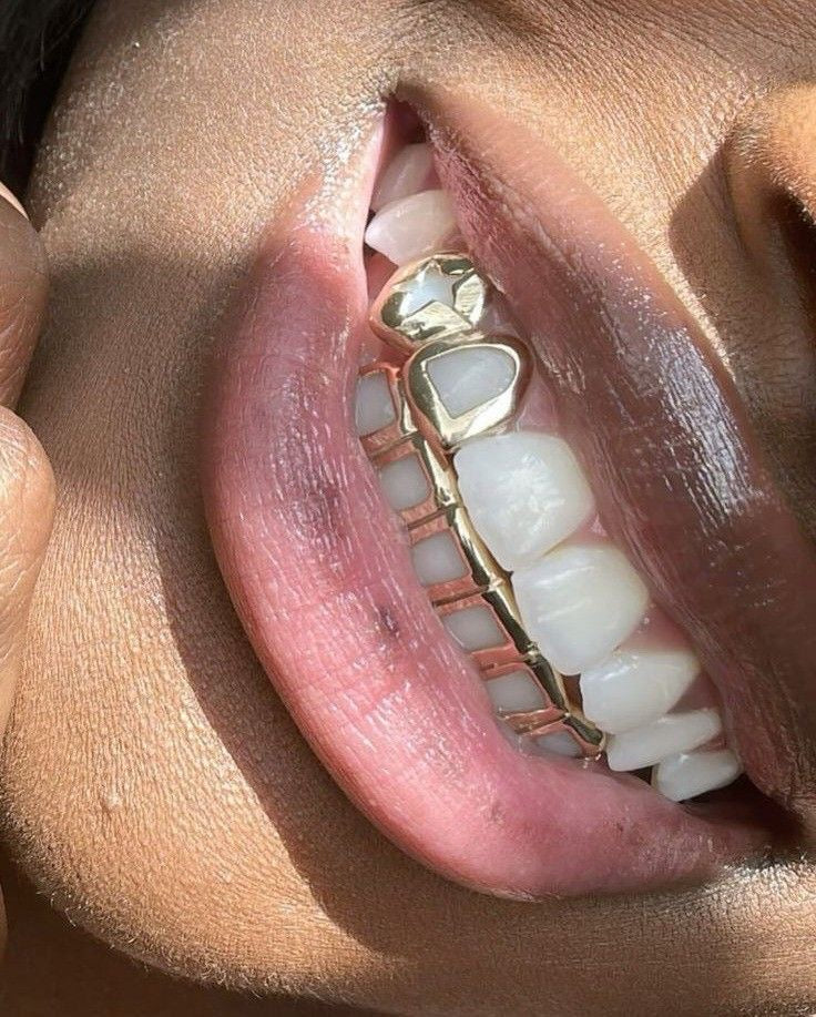 Grillz Or 18K vs Argent 925 : Comparatif Complet 2026 – Lequel Choisir en France ?