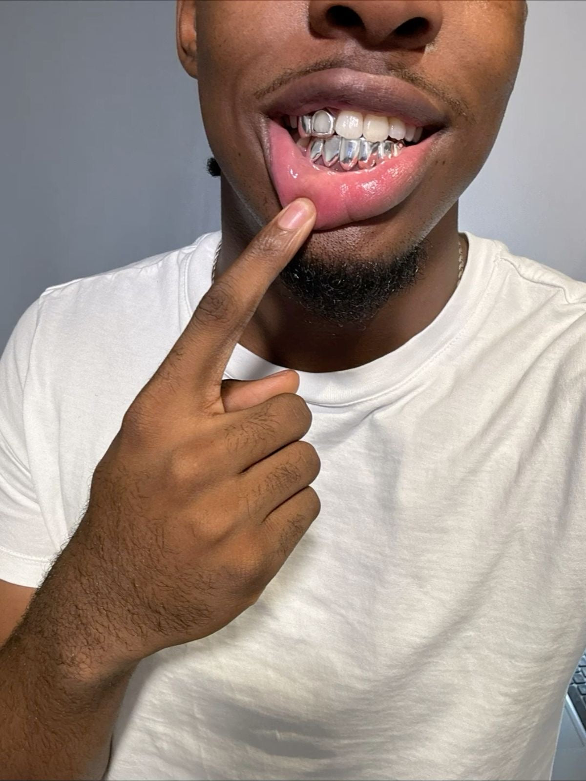 Grillz Paris : grillz en argent sur mesure en Île-de-France