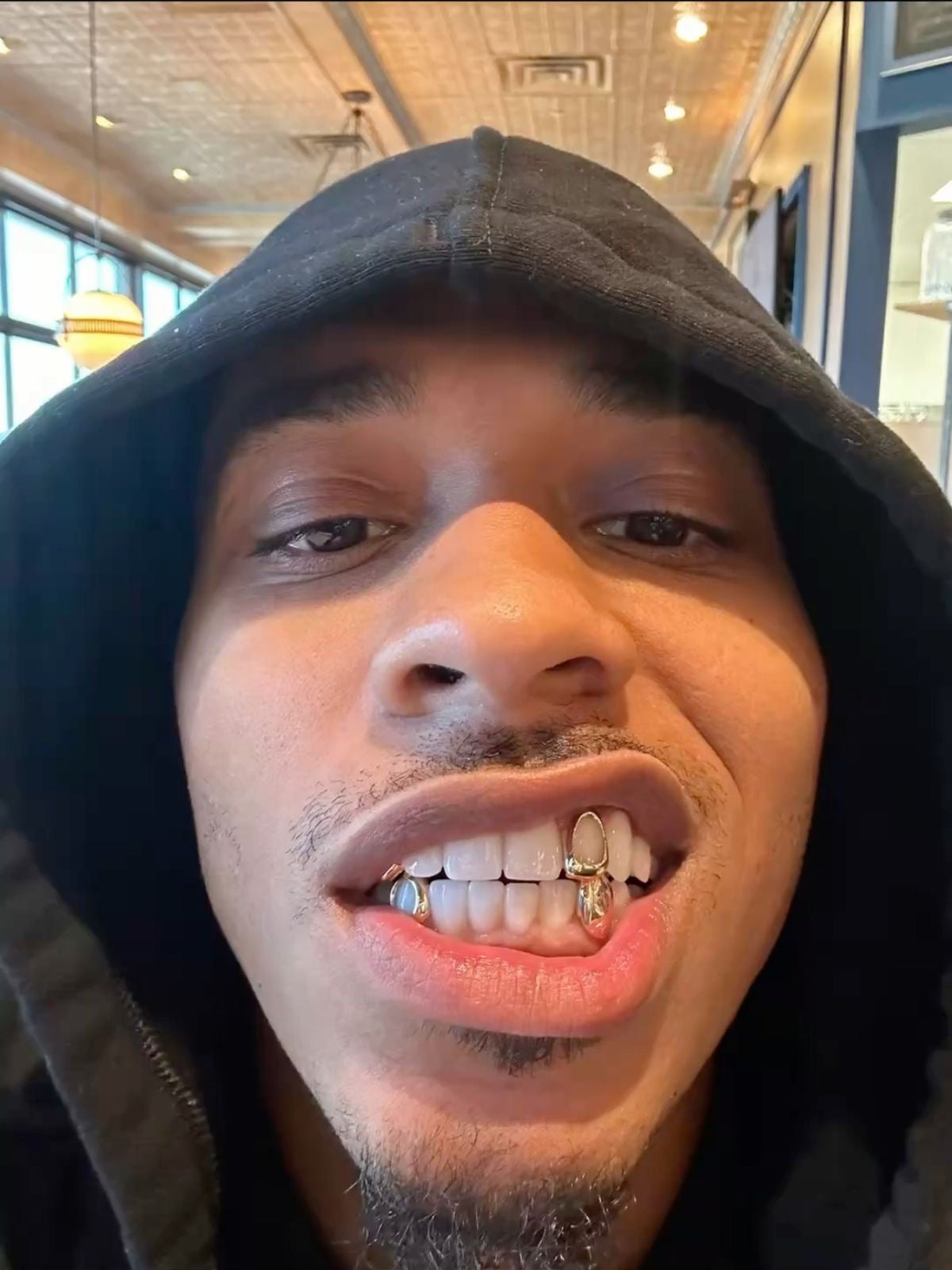 Grillz à Toulouse : Découvrez les Créations Exclusives de Grillz Worldwide