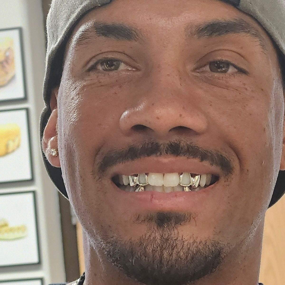 Grillz en argent à Rennes et Nantes : le guide complet pour un grillz sur mesure