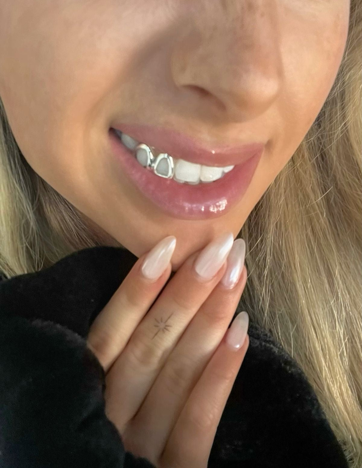 Grillz Limoges : Guide complet, prix et sur mesure (2026)