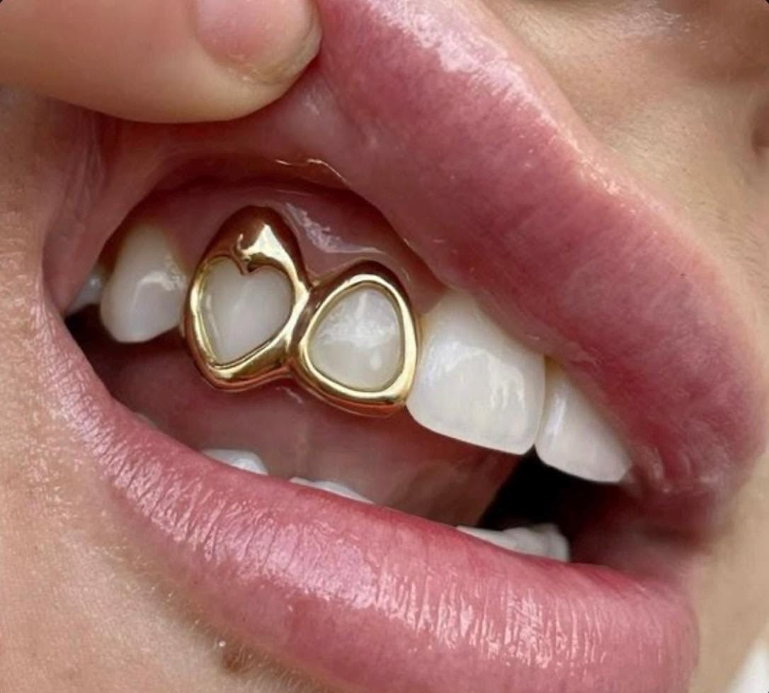 Grillz : Le Guide Ultime des Bijoux Dentaires en Argent à Dijon, Besançon et Troyes