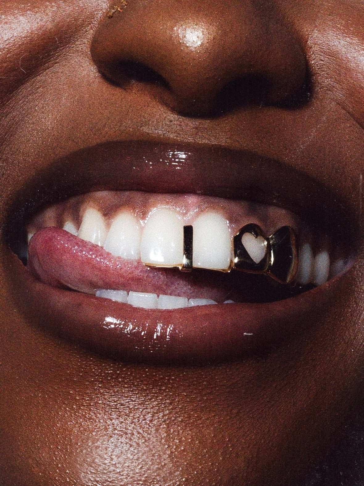 Grillz en Argent : Bijoux Dentaires à Caen, Le Havre et Rouen (Guide Complet)