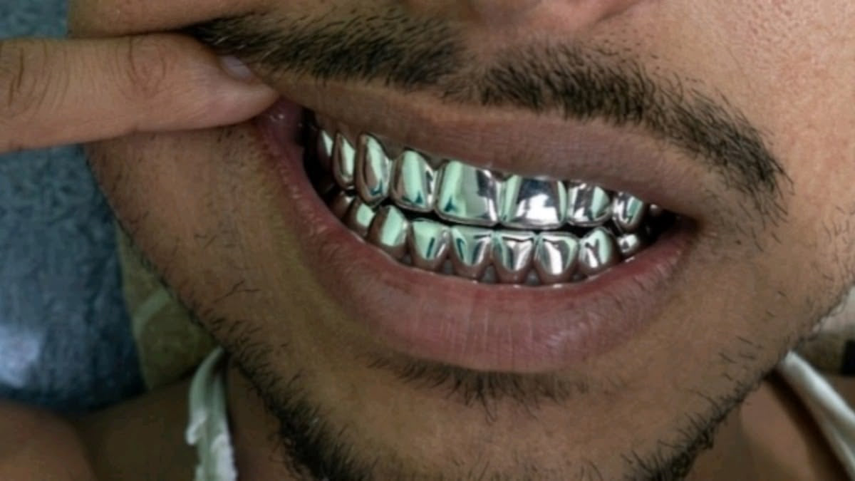 Grillz Le Mans : Prix, création sur mesure et conseils (2026)