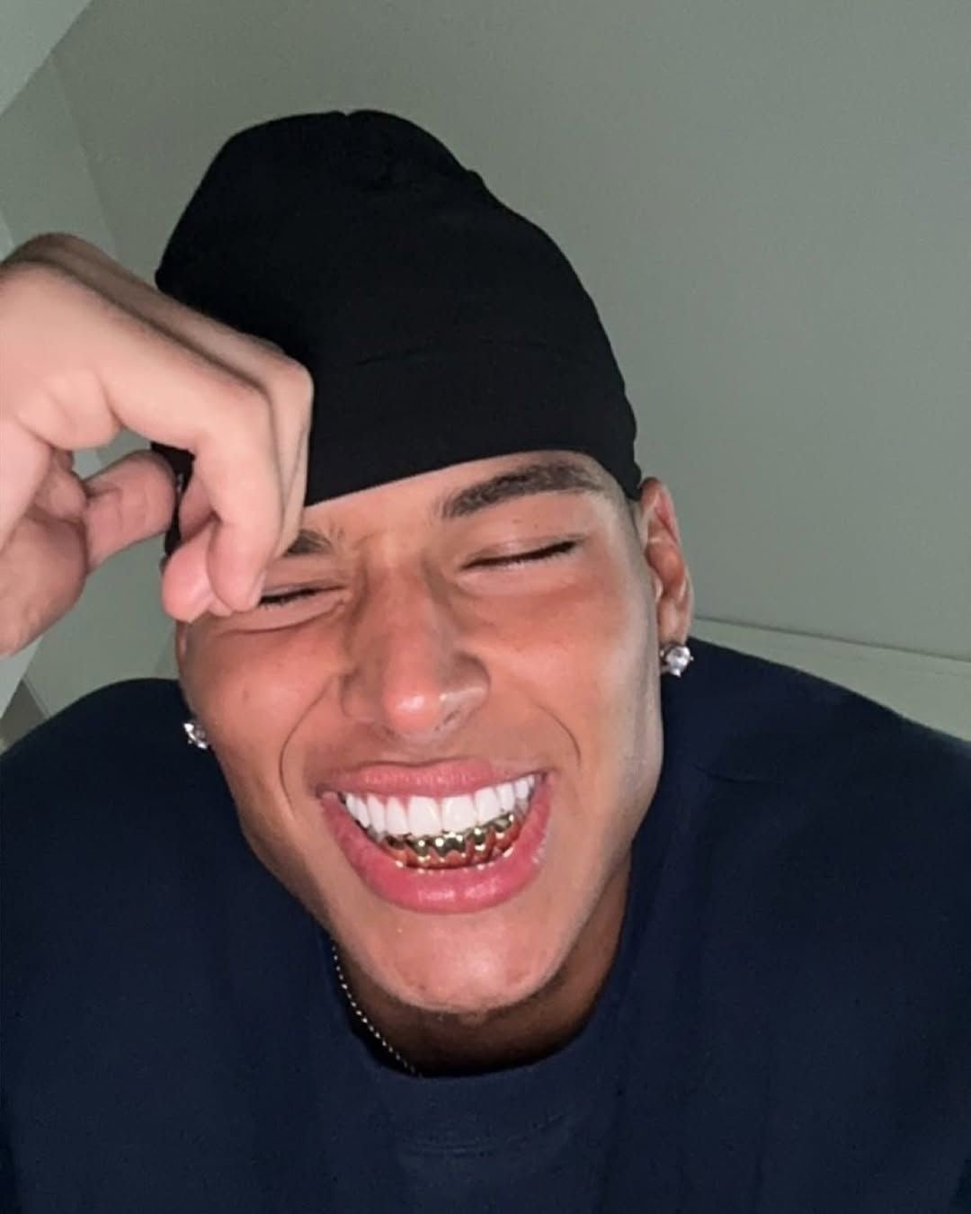 Grillz Amiens : Prix, création sur mesure et conseils (2026)