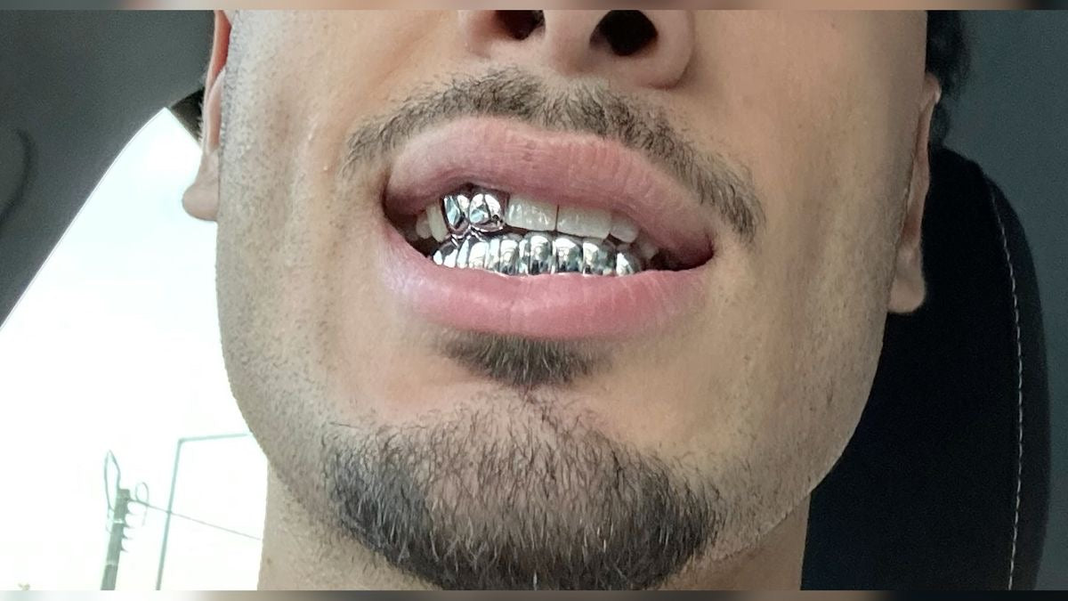 Grillz Paris banlieue : Montreuil, Saint-Denis – Prix, sur mesure et guide complet (2026)
