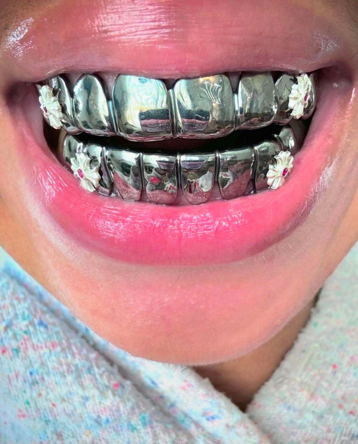 Grillz Monaco : Bijou dentaire de luxe sur mesure – Prix et guide complet (2026)