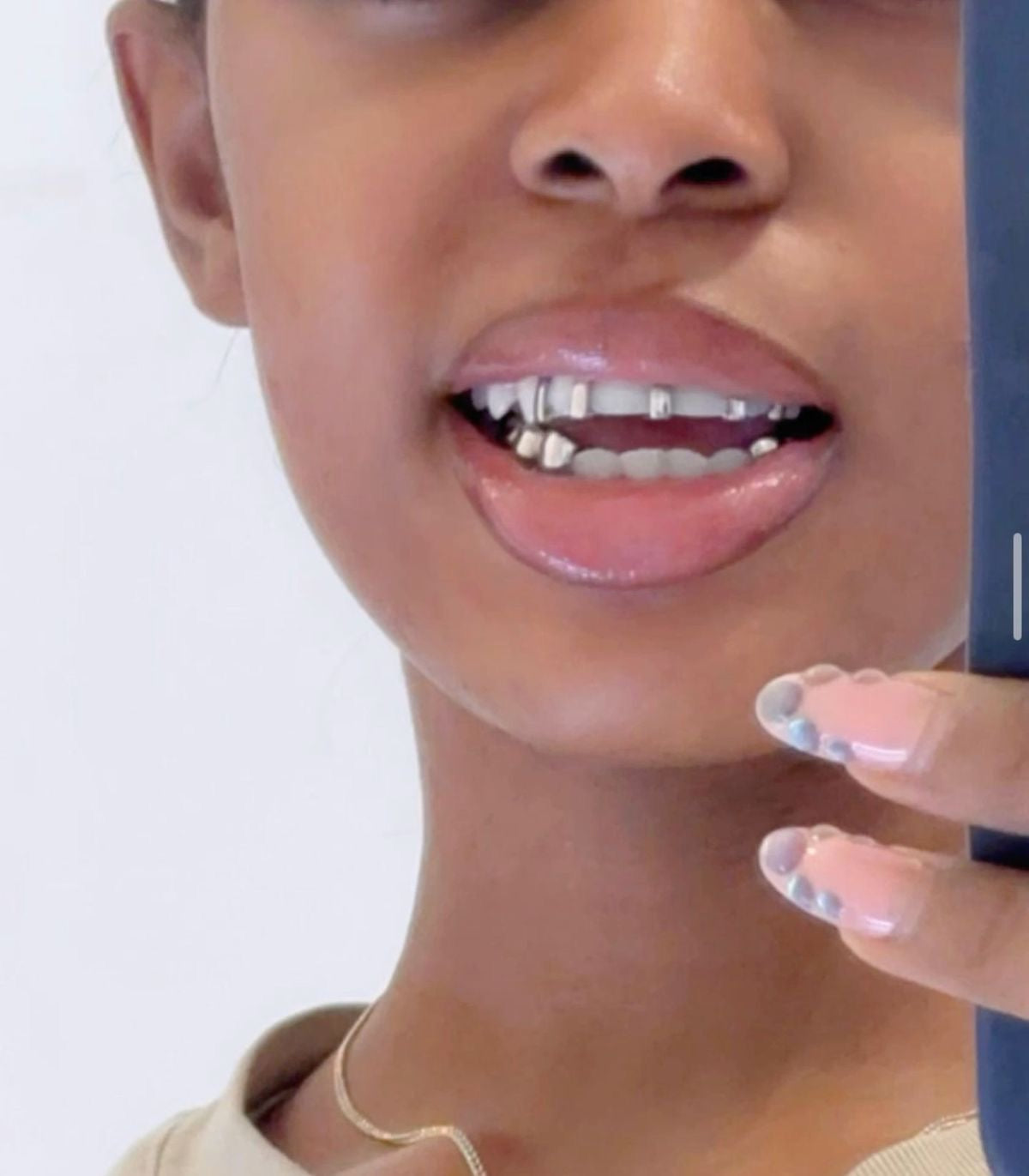 Grillz Bordeaux : Création de grillz sur mesure à distance avec Grillz Worldwide (2026)