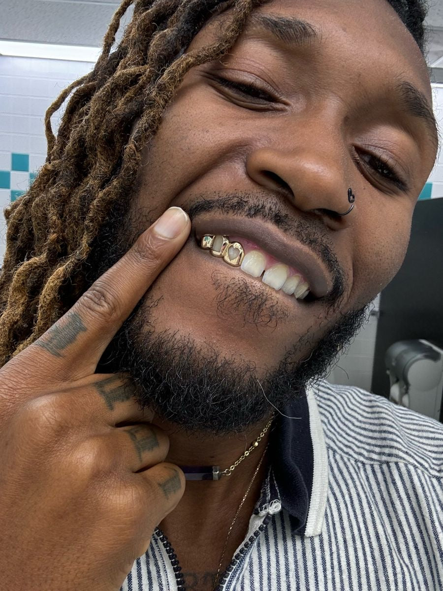 Grillz Lyon : Création de grillz sur mesure avec Grillz Worldwide (2026)
