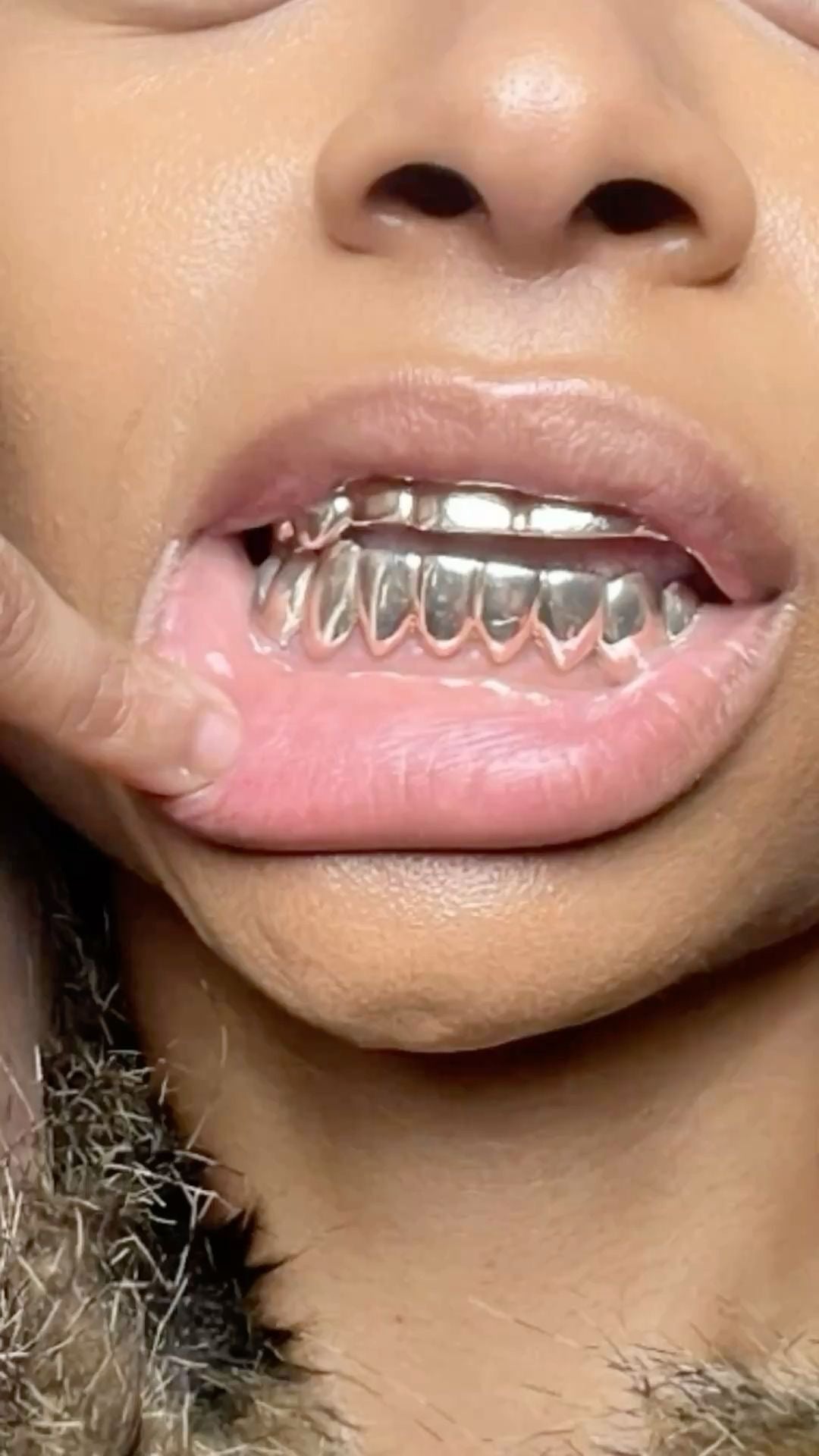 Grillz Montpellier : Création de grillz sur mesure avec Grillz Worldwide (2026)