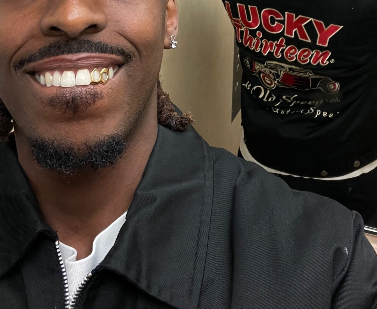 Grillz Boulogne-sur-Mer : Création de grillz sur mesure à distance avec Grillz Worldwide (2026)