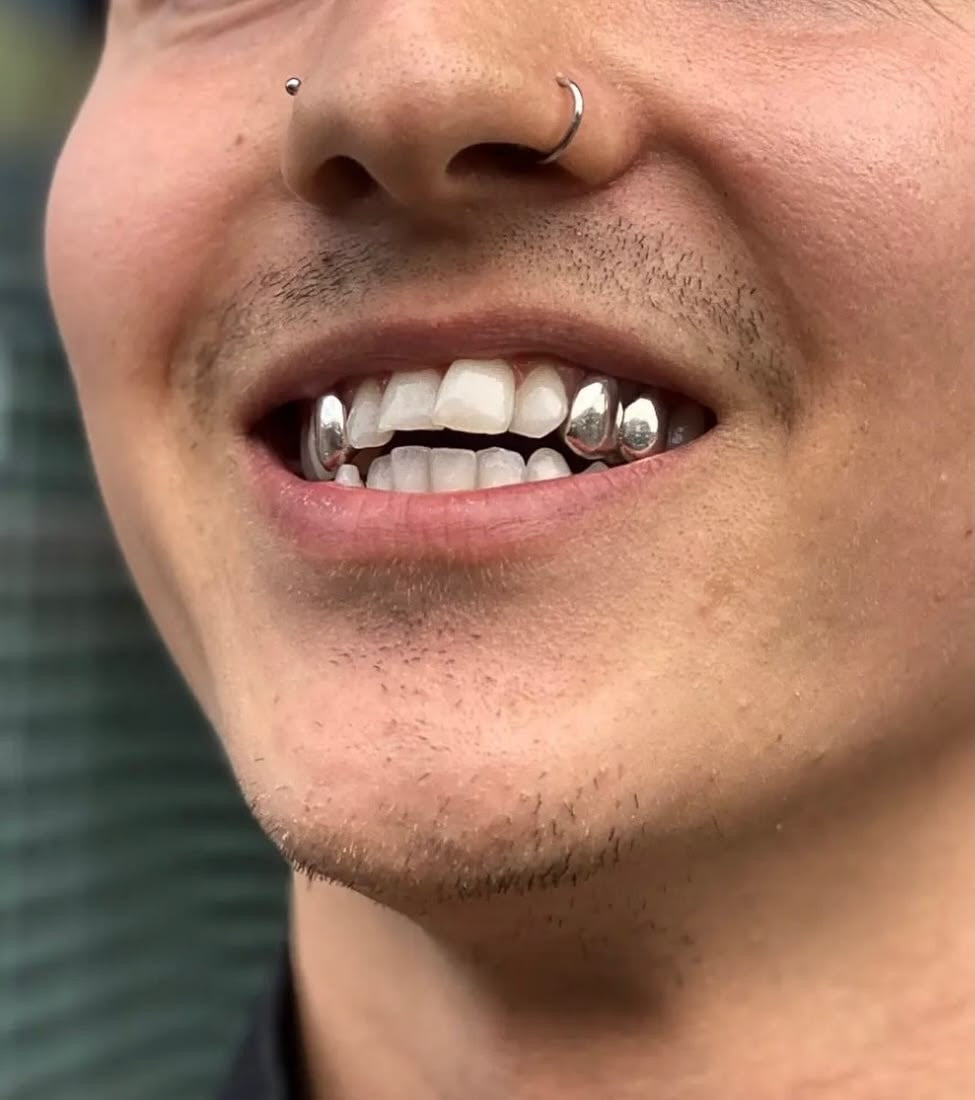 Grillz Auxerre : Création de grillz sur mesure à distance avec Grillz Worldwide (2026)