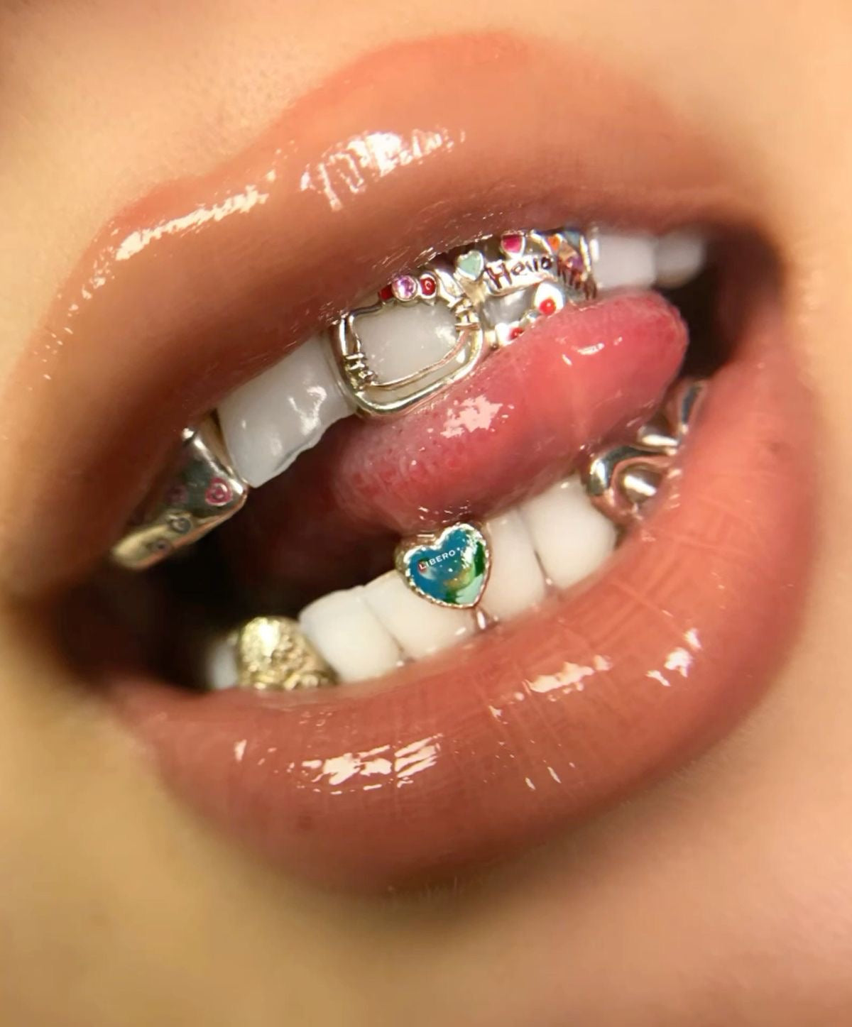 Grillz dentaires : Qualité, sécurité, et différences avec les facettes – Le guide complet pour acheter ses grillz en France