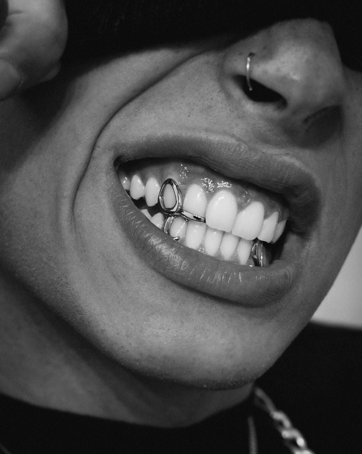 Grillz Belgique : Création de grillz sur mesure à Bruxelles, Liège, Anvers, Charleroi et Gand
