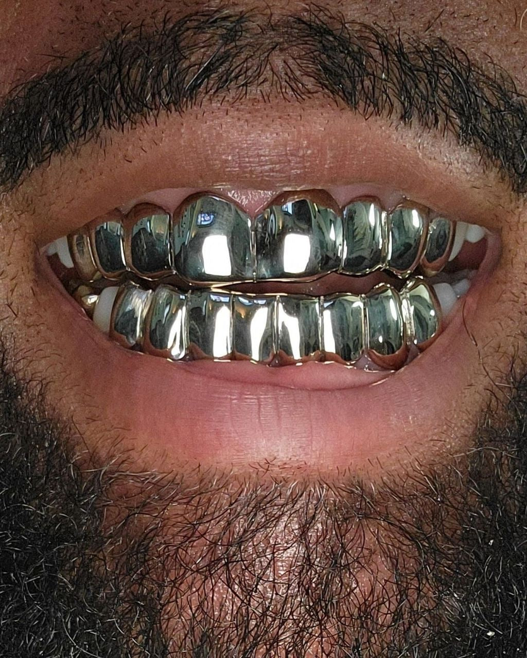 Grillz Belgique : Création de grillz sur mesure avec Grillz Worldwide (2026)