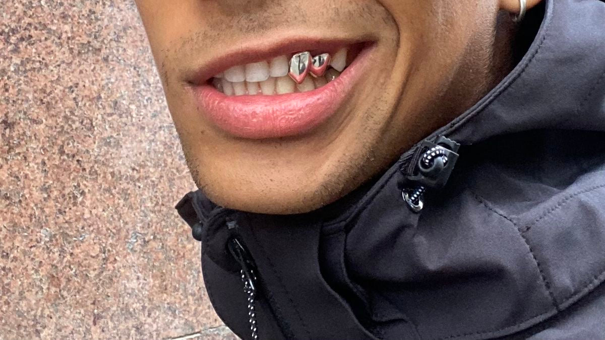 Prix des Grillz en Suisse en 2026 : Combien coûtent des grillz en argent et en or ?