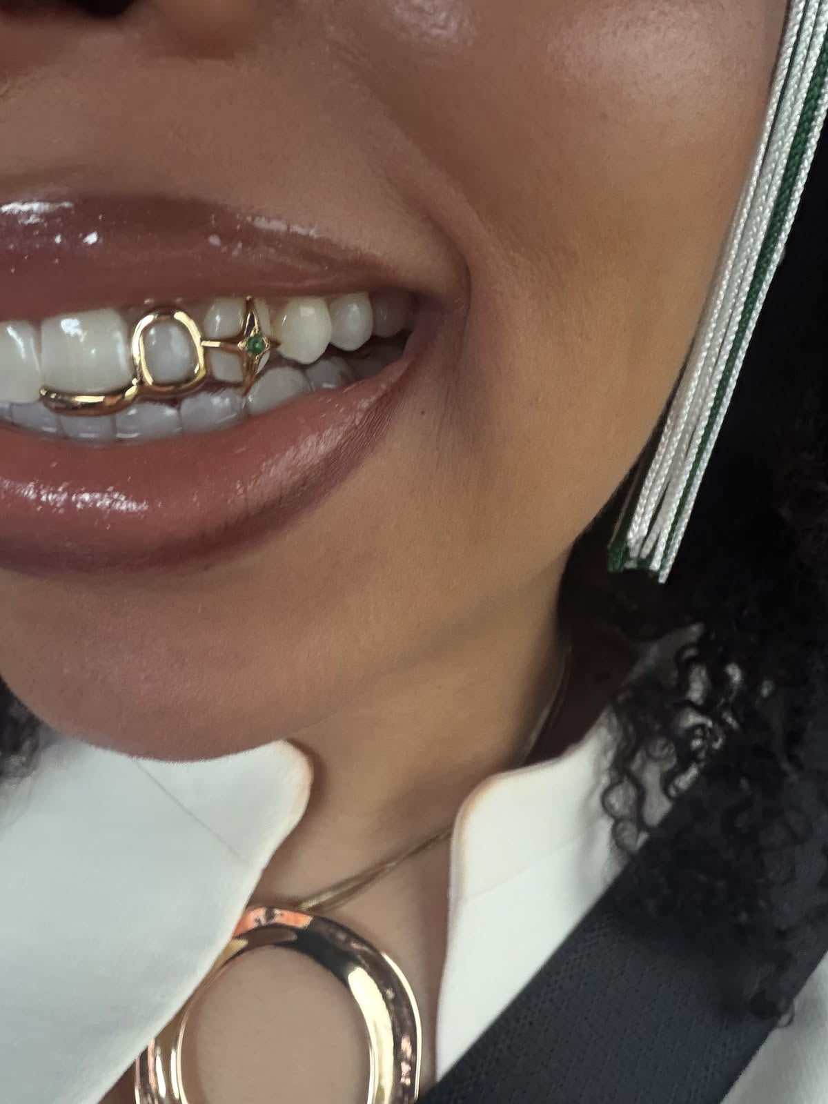 Grillz Luxembourg  Grillz Or, Argent & Diamants Sur Mesure
