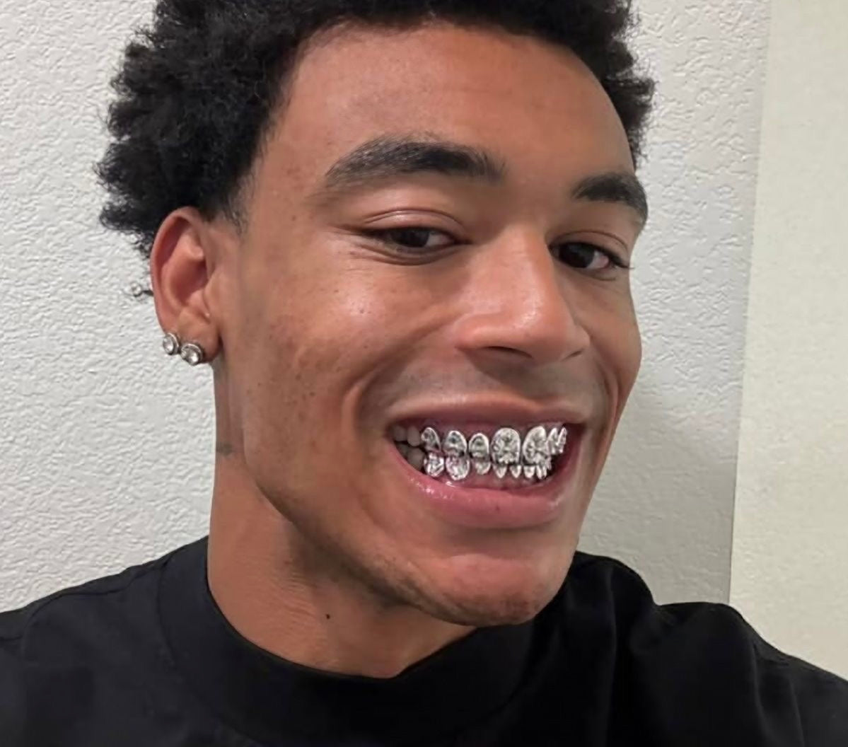 Pourquoi les Résidents de Monaco Choisissent les Grillz Sur Mesure en 2026