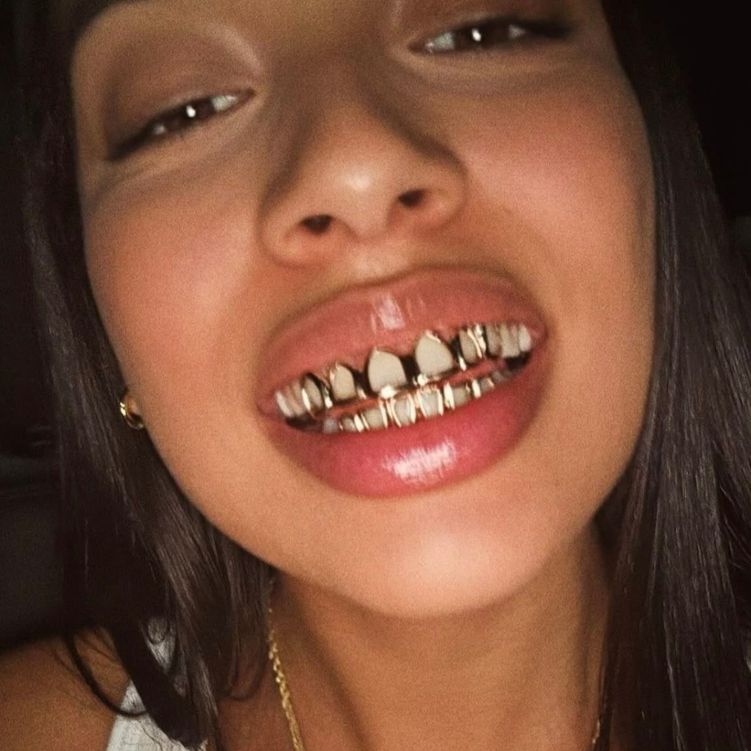 Pose de grillz : chez le dentiste ou à domicile ? Les meilleures solutions avec Grillz Worldwide