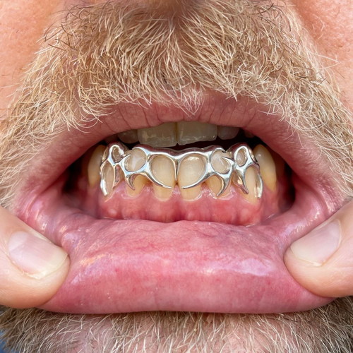 Entretien et nettoyage de vos grillz : nos meilleures astuces pour les garder comme neufs