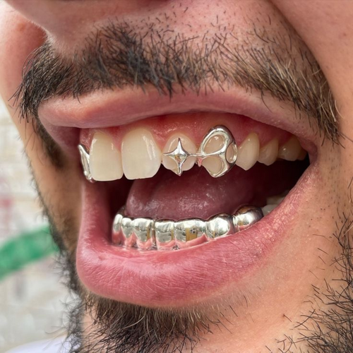 Comment Choisir ses Grillz : Matériaux, Styles et Personnalisation