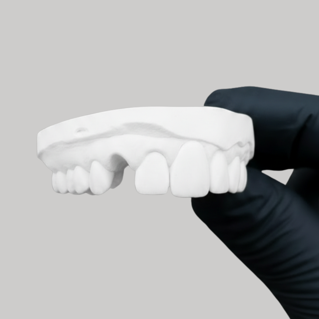 Grillz dents manquantes