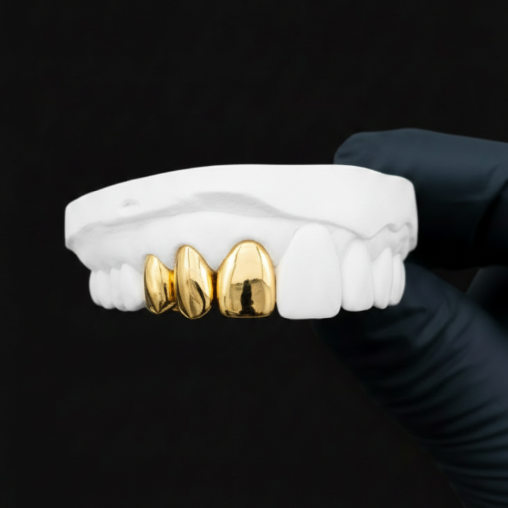 Grillz dents manquantes