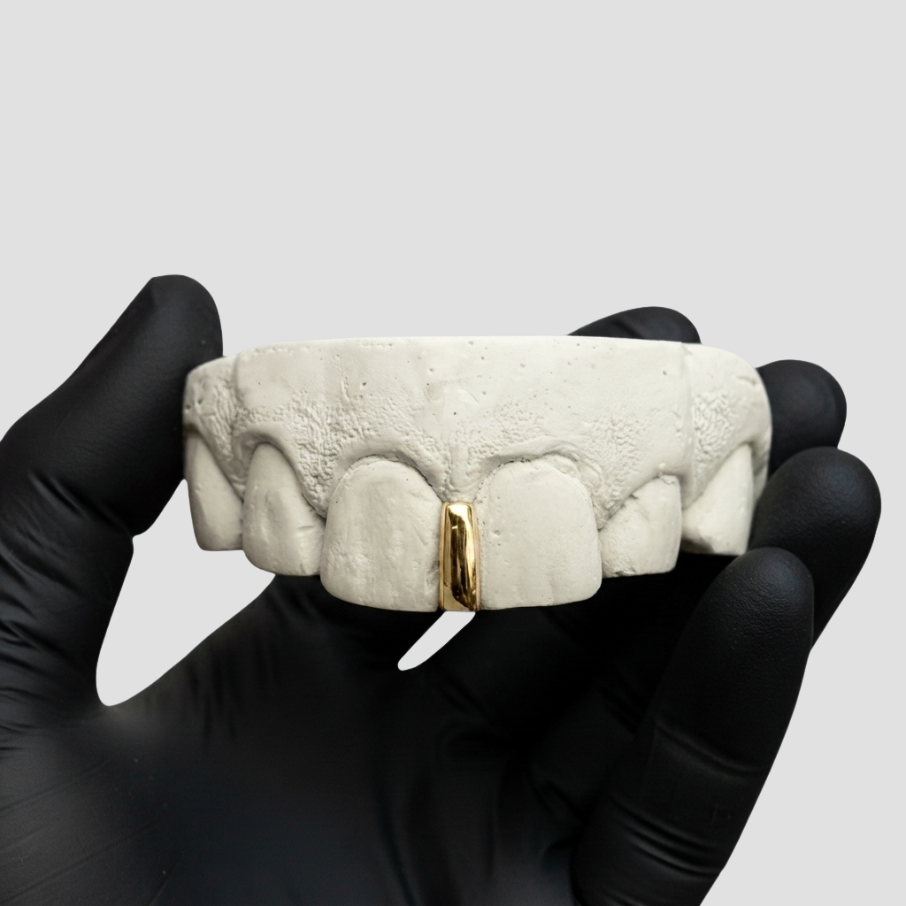 interstice Grillz